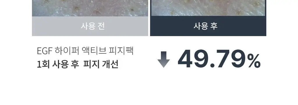[100만장 판매 피지팩]프롬리에 EGF 피지팩 하이퍼 액티브 모공 피지 마스크 4매 상세페이지 15